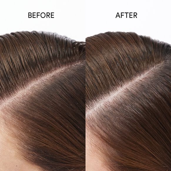 Pure Genius Scalp Restoring Oil